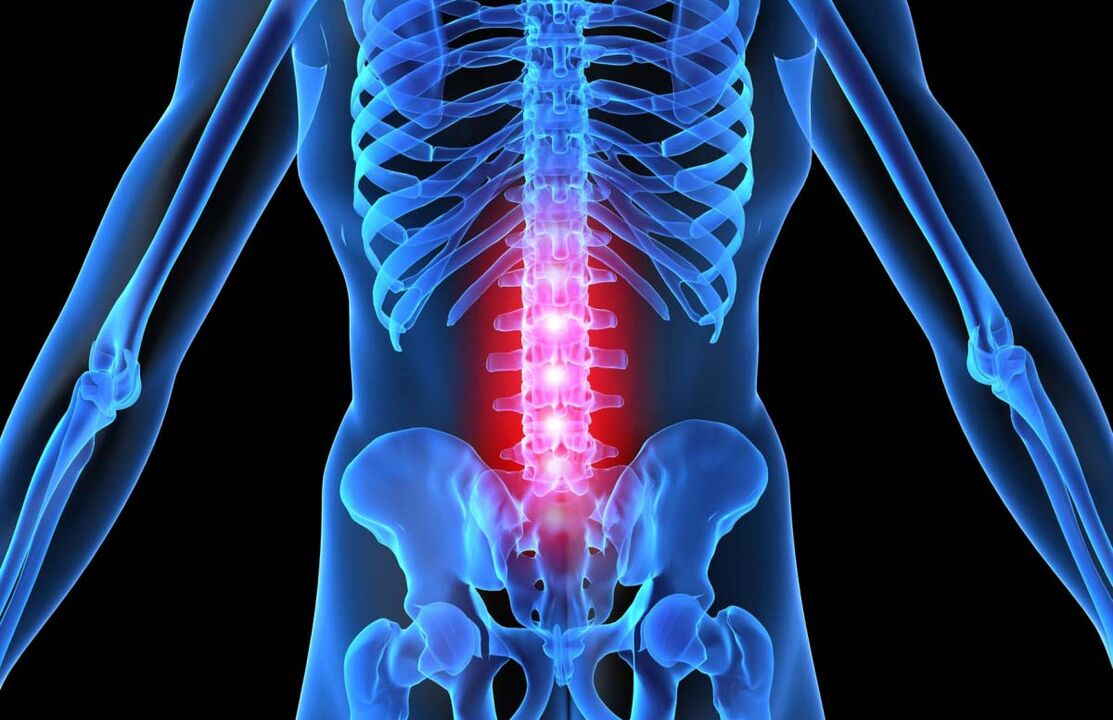 segít az osteochondrosisban)